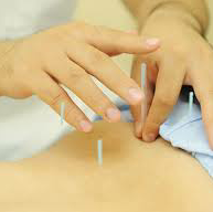 鍼灸師が悩みに答えます