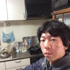 リュウスケのトーク