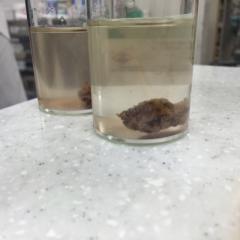 扁桃腺摘出して声出ないから755