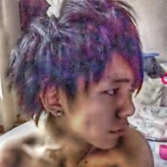 胸骨骨折した奴のトーク