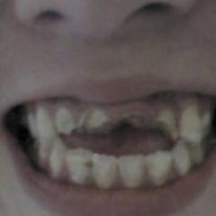 運営により削除されました