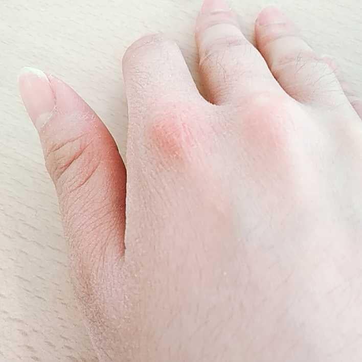 かりんの悩み、聴いてよちょこら