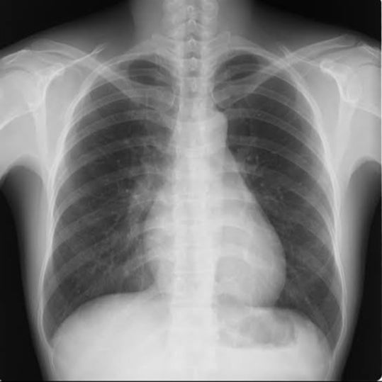 ロベルトくるみーの